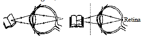Optical instrument eyeglasses – problems and solutions 1