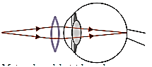 Optical instrument eyeglasses – problems and solutions 4